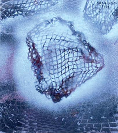 duetart - Yayoi Kusama